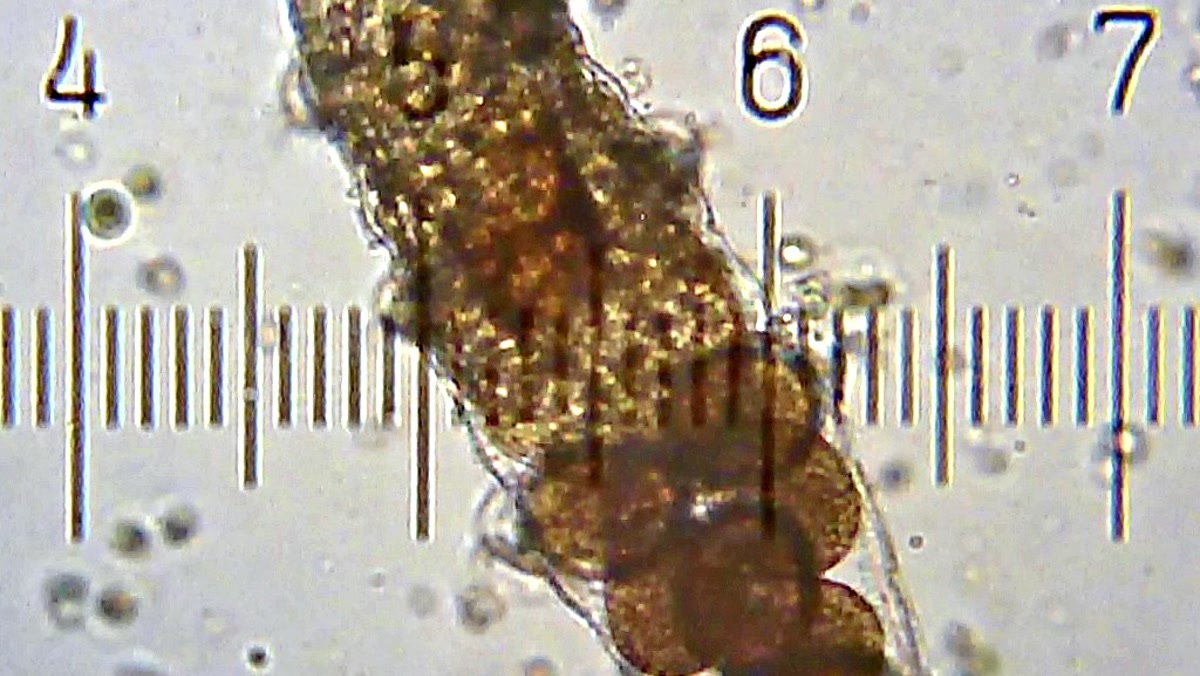 Telur tardigrada di dalam kutikula yang terlepas, dipotret melalui mikroskop pada 11 September 2016. Foto dipotong dan disesuaikan ukurannya; warna tidak dimanipulasi.